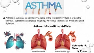 Asthma is a chronic inflammatory disease of the respiratory system in which the
airways . Symptoms can include coughing, wheezing, shortness of breath and chest
tightness.
Mokshada .R.
Bhirud
M.Pharm
 