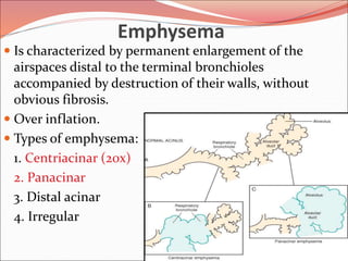 Emphysema
 Is characterized by permanent enlargement of the
airspaces distal to the terminal bronchioles
accompanied by destruction of their walls, without
obvious fibrosis.
 Over inflation.
 Types of emphysema:
1. Centriacinar (20x)
2. Panacinar
3. Distal acinar
4. Irregular
 