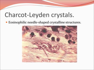 Charcot-Leyden crystals.
 Eosinophilic needle-shaped crystalline structures.
 