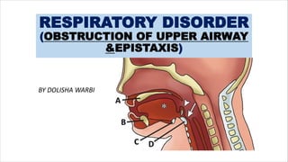 RESPIRATORY DISORDER
(OBSTRUCTION OF UPPER AIRWAY
&EPISTAXIS)
BY DOLISHA WARBI
 