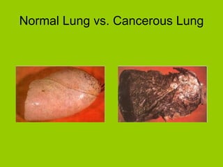Normal Lung vs. Cancerous Lung 