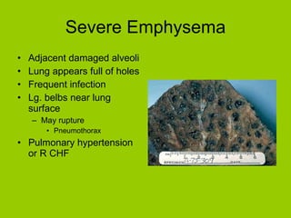 Severe Emphysema Adjacent damaged alveoli  Lung appears full of holes Frequent infection Lg. belbs near lung surface May rupture Pneumothorax Pulmonary hypertension or R CHF  