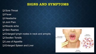 SIGNS AND SYMPTOMS
 Sore Throat
 Fever
 Headache
 Joint Pain
 Muscle ache
 Skin Rashes
 Enlarged lymph nodes in neck and armpits
 Swollen Tonsils
 Loss of Appetite
 Enlarged Spleen and Liver
 