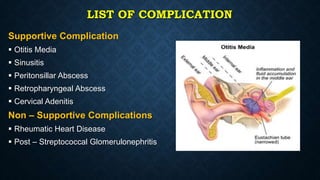 LIST OF COMPLICATION
Supportive Complication
 Otitis Media
 Sinusitis
 Peritonsillar Abscess
 Retropharyngeal Abscess
 Cervical Adenitis
Non – Supportive Complications
 Rheumatic Heart Disease
 Post – Streptococcal Glomerulonephritis
 