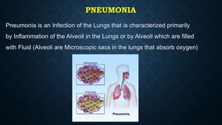 PNEUMONIA
Pneumonia is an Infection of the Lungs that is characterized primarily
by Inflammation of the Alveoli in the Lungs or by Alveoli which are filled
with Fluid (Alveoli are Microscopic sacs in the lungs that absorb oxygen)
 