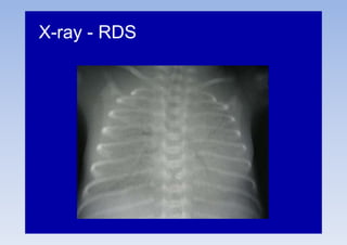 Approach to Respiratory distress in neonates ppt | PPTX