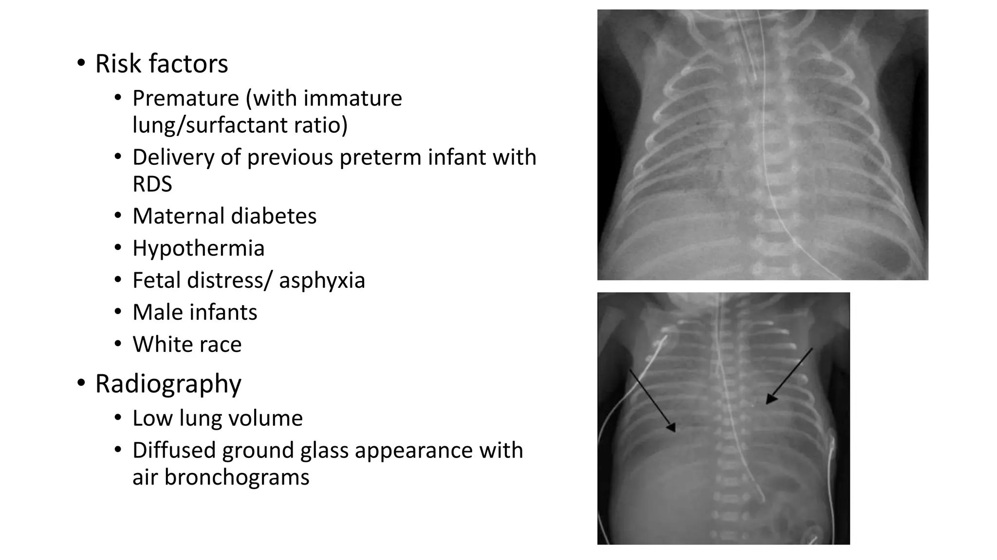 Respiratory Distress in Newborn.pptx