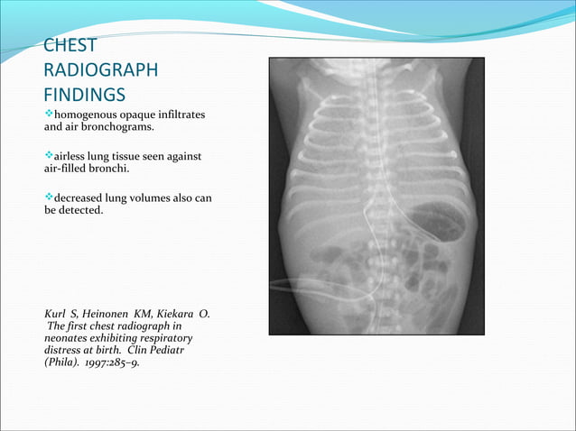 Respiratory Distress in The Newborn | PPT | Pregnancy | Reproductive Health