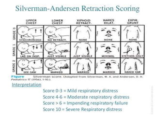Respiratory distress in the newborn | PPTX