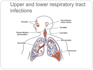 Respiratory Dysfunctions in Children ,.ppt