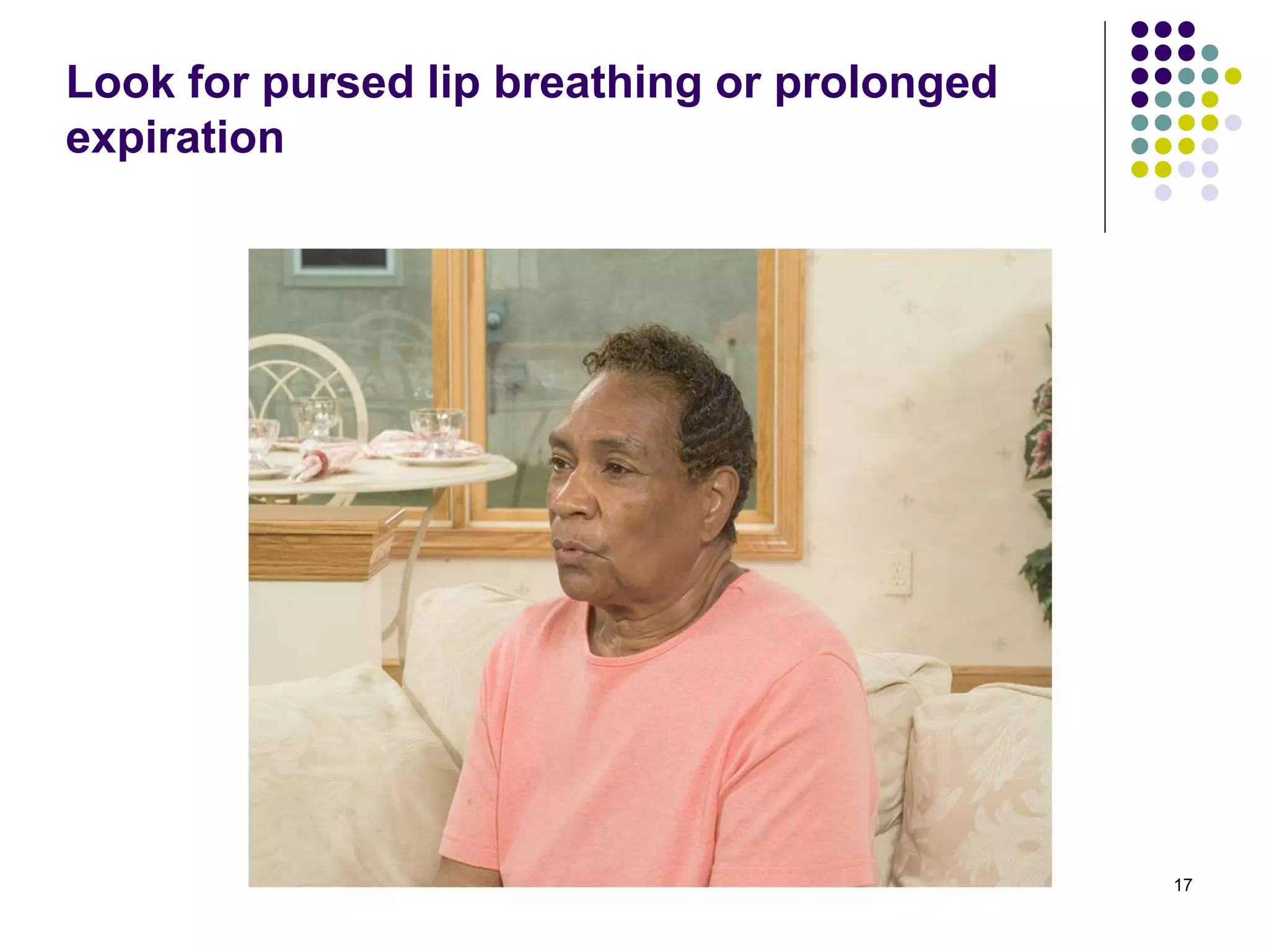 Barry Kidd 2010 17
Look for pursed lip breathing or prolonged
expiration
 