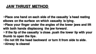 Cardiopulmonary resuscitation according to respiratory emergencies | PDF