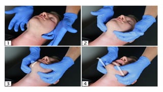 Cardiopulmonary resuscitation according to respiratory emergencies | PDF