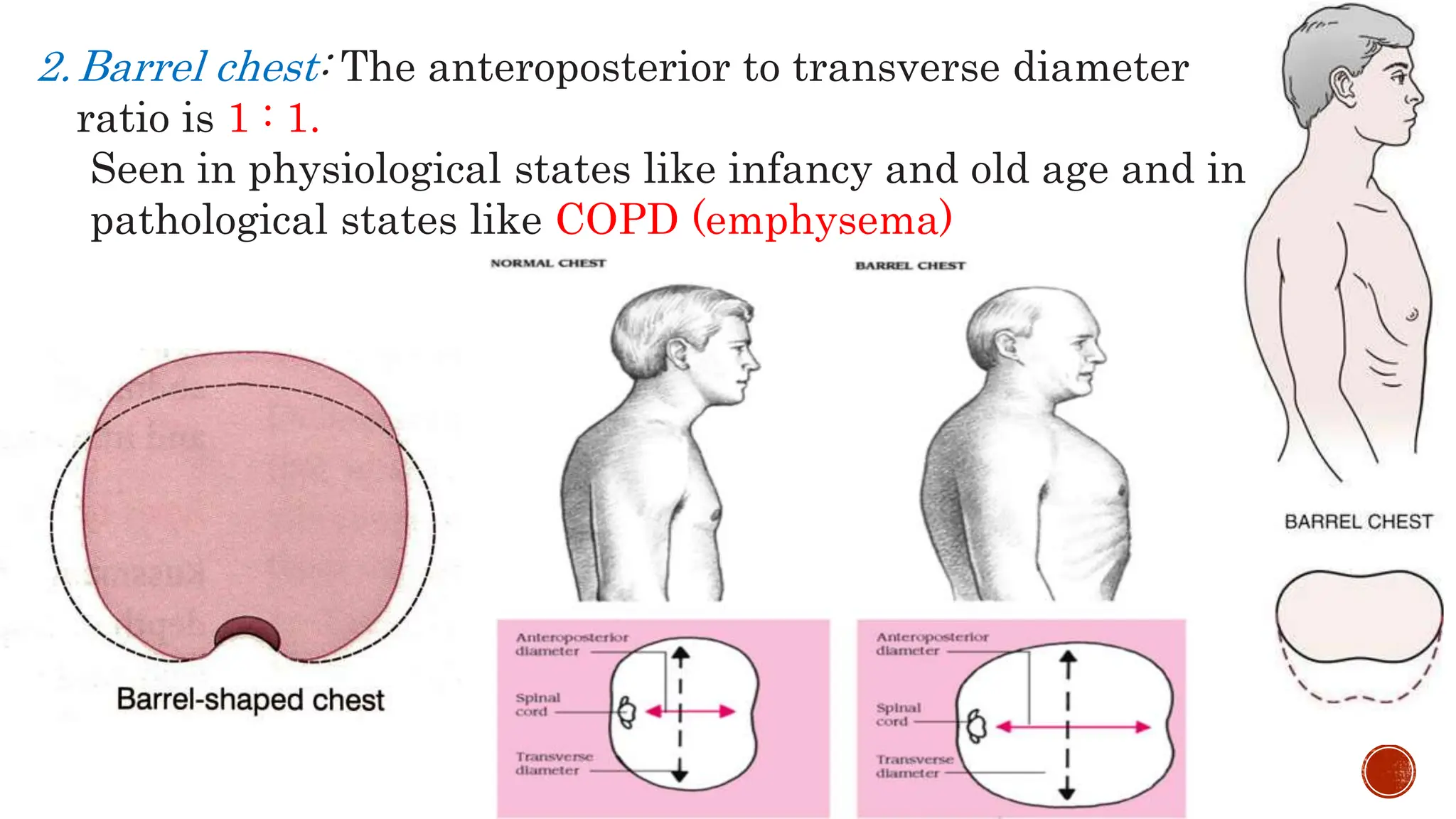 RESPIRATORY EXAMINATION FINAL PPT DR,.pptx