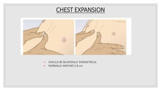 CHEST EXPANSION
• SHOULD BE BILATERALLY SYMMETRICAL
• NORMALLY AROUND 5-8 cm
 