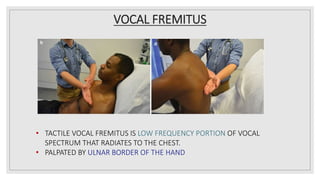VOCAL FREMITUS
• TACTILE VOCAL FREMITUS IS LOW FREQUENCY PORTION OF VOCAL
SPECTRUM THAT RADIATES TO THE CHEST.
• PALPATED BY ULNAR BORDER OF THE HAND
 