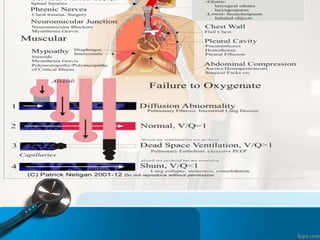 respiratoryfailrefinal-1605121128522.ppt