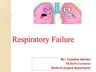 By:- kanchan sharma
M.Sc(N) Lecturer
Medical surgical department
Respiratory Failure
 