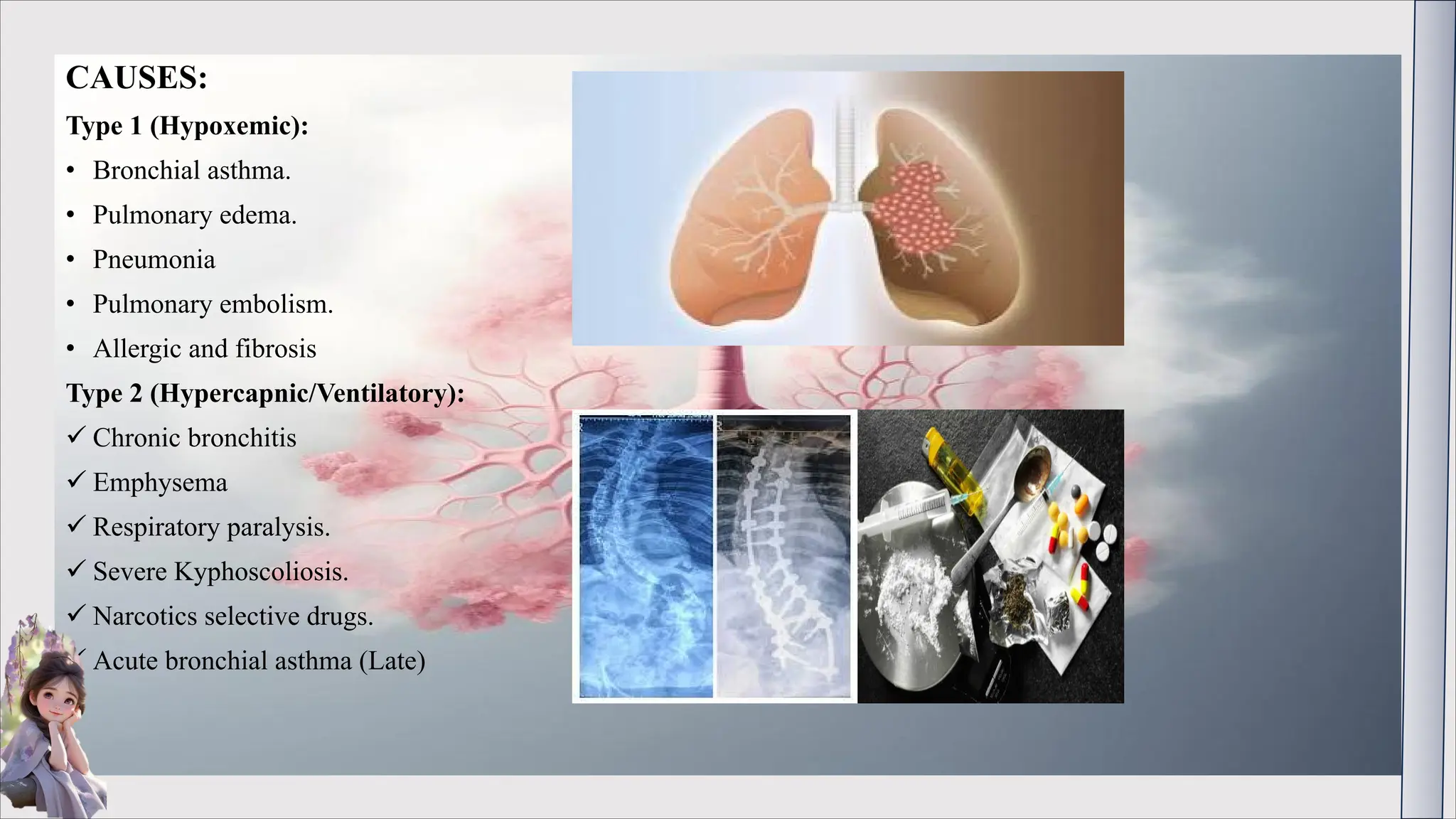 CAUSES:
Type 1 (Hypoxemic):
• Bronchial asthma.
• Pulmonary edema.
• Pneumonia
• Pulmonary embolism.
• Allergic and fibrosis
Type 2 (Hypercapnic/Ventilatory):
ü Chronic bronchitis
ü Emphysema
ü Respiratory paralysis.
ü Severe Kyphoscoliosis.
ü Narcotics selective drugs.
ü Acute bronchial asthma (Late)
 