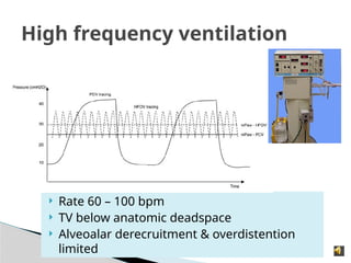  Rate 60 – 100 bpm
 TV below anatomic deadspace
 Alveoalar derecruitment & overdistention
limited
High frequency ventilation
 