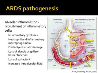 Respiratory failure and the acute respiratory distress syndrome (and ...