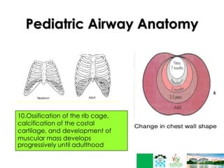 Pediatric Airway Anatomy
10.Ossification of the rib cage,
calcification of the costal
cartilage, and development of
muscular mass develops
progressively until adulthood
 