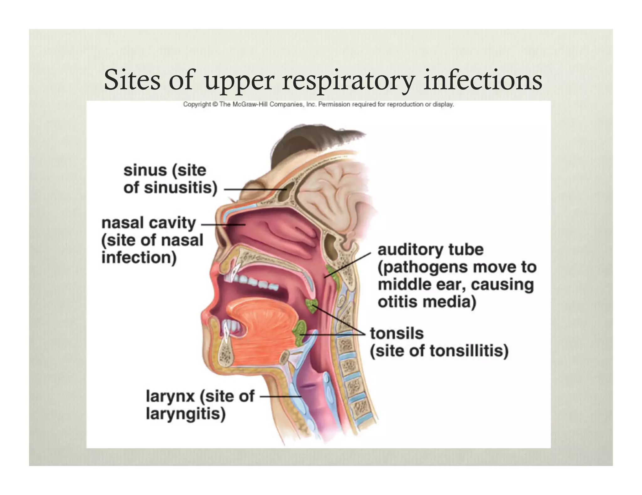 Sites of upper respiratory infections
 