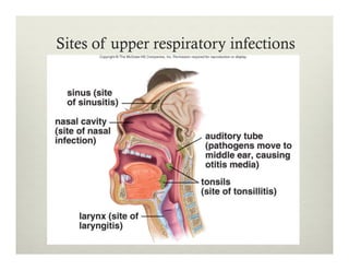 Sites of upper respiratory infections
 