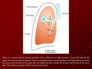 There is a vertical pleural pressure gradient with a difference of approximately 7.5cm H 2O between the
upper most and lowermost regions, Causes a transpulmonary pressure gradient with higher pressure inside
the airway and alveolus in the upper part and higher pressure outside the alveolus and airway in the lower
part, This results in closure of the airways in lower part.

 