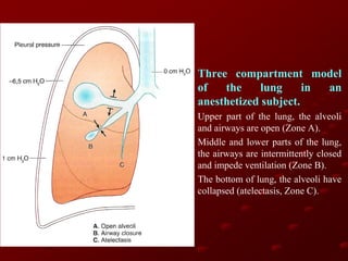 Three compartment model
of
the
lung
in
an
anesthetized subject.
Upper part of the lung, the alveoli
and airways are open (Zone A).
Middle and lower parts of the lung,
the airways are intermittently closed
and impede ventilation (Zone B).
The bottom of lung, the alveoli have
collapsed (atelectasis, Zone C).

 