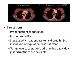 • Limitations:
– Proper patient cooperation
– Less reproducible
– Stage at which patient has to hold breath (End
inspiration or expiration) was not clear.
– To improve cooperation audio guided and video
guided methods are available.
 