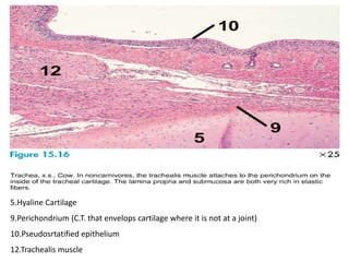5.Hyaline Cartilage
9.Perichondrium (C.T. that envelops cartilage where it is not at a joint)
10.Pseudosrtatified epithelium
12.Trachealis muscle
 