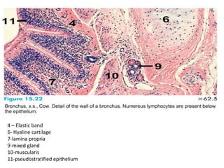4 – Elastic band
6- Hyaline cartilage
7-lamina propria
9-mixed gland
10-muscularis
11-pseudostratified epithelium
 