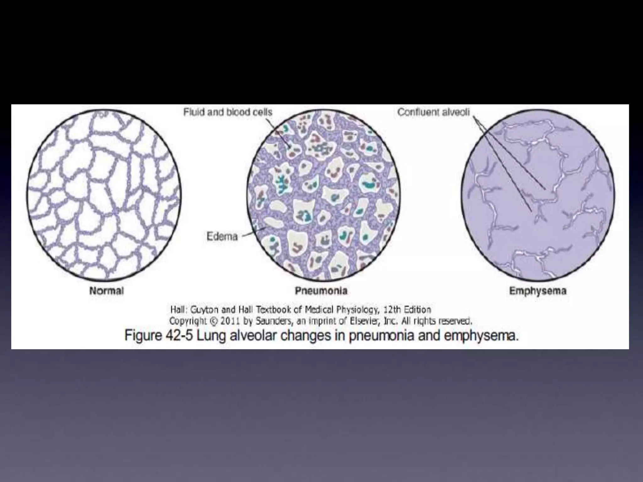Respiratory insufficiency pathophysiology, diagnosis, oxygen therapy | PPT