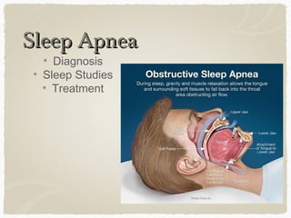 Sleep ApneaSleep Apnea
Diagnosis
Sleep Studies
Treatment
 