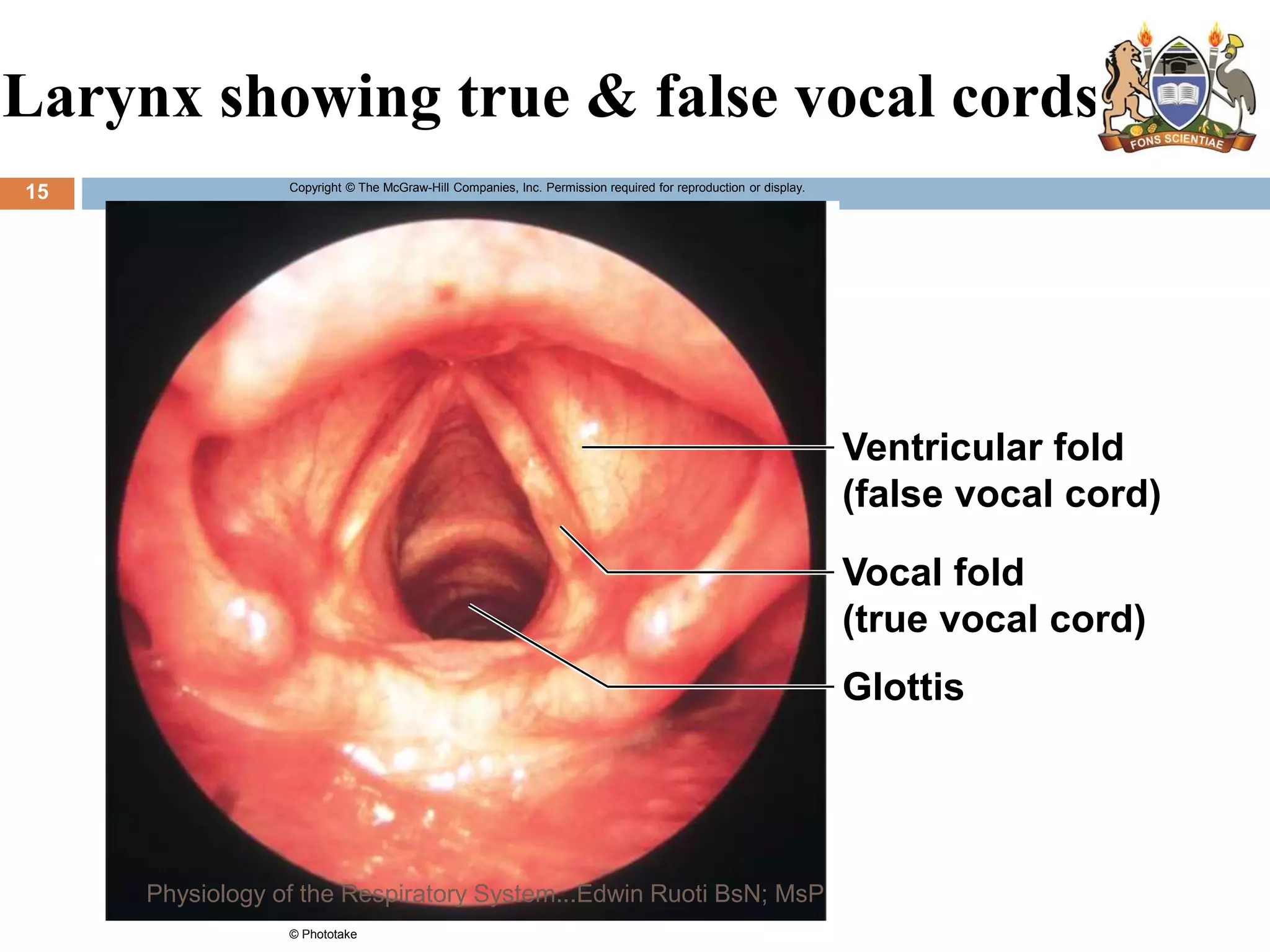 Larynx showing true & false vocal cords
Copyright © The McGraw-Hill Companies, Inc. Permission required for reproduction or display.
Ventricular fold
(false vocal cord)
Vocal fold
(true vocal cord)
Glottis
© Phototake
15
Physiology of the Respiratory System...Edwin Ruoti BsN; MsP
 