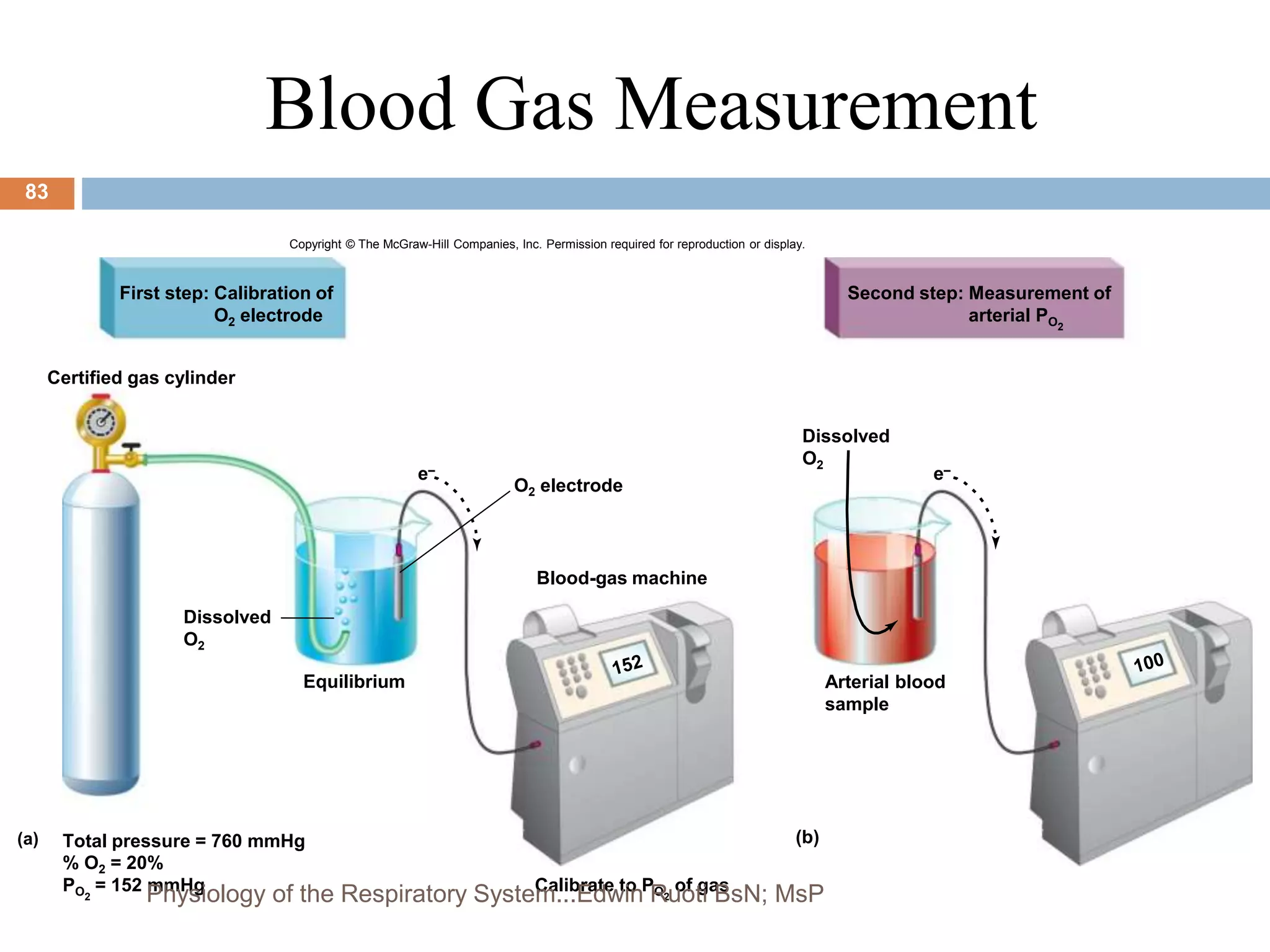 Blood Gas Measurement
Copyright © The McGraw-Hill Companies, Inc. Permission required for reproduction or display.
e–
Certified gas cylinder
First step: Calibration of
O2 electrode
Second step: Measurement of
arterial PO2
Dissolved
O2
O2 electrode
Blood-gas machine
Arterial blood
sample
(b)
Calibrate to PO2
of gas
Total pressure = 760 mmHg
% O2 = 20%
PO2
= 152 mmHg
Equilibrium
Dissolved
O2
e–
(a)
83
Physiology of the Respiratory System...Edwin Ruoti BsN; MsP
 