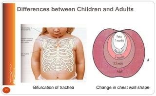Differences between Children and Adults
Bifurcation of trachea Change in chest wall shape
11
 