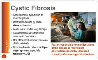 Cystic Fibrosis
 Genetic illness, dysfunction of
exocrine glands
 Obstruction caused by thick,
viscous mucous
 Leads to irreversible lung damage
 Autosomal recessive trait: more
common in Caucasians
 One of the most common causes of
childhood death
 Complex disorder: affects multiple
organ systems, especially
respiratory & GI
Factor responsible for manifestations
of the disease is mechanical
obstruction caused by increased
viscosity of mucous gland secretions
131
 