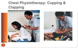 Chest Physiotherapy: Cupping &
Clapping
153
 