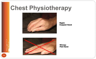 Chest Physiotherapy
154
 