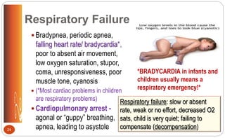 Respiratory Failure
 Bradypnea, periodic apnea,
falling heart rate/ bradycardia*,
poor to absent air movement,
low oxygen saturation, stupor,
coma, unresponsiveness, poor
muscle tone, cyanosis
 (*Most cardiac problems in children
are respiratory problems)
 Cardiopulmonary arrest -
agonal or “guppy” breathing,
apnea, leading to asystole24
Respiratory failure: slow or absent
rate, weak or no effort, decreased O2
sats, child is very quiet; failing to
compensate (decompensation)
*BRADYCARDIA in infants and
children usually means a
respiratory emergency!*
 