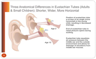 Three Anatomical Differences in Eustachian Tubes (Adults
& Small Children): Shorter, Wider, More Horizontal
39
 