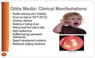Otitis Media: Clinical Manifestations
• Sudden piercing pain; irritability
• Fever (as high as 104°F [40°C])
• Vomiting, diarrhea
• Rubbing or pulling at ear
• Rolling head from side to side
• Night awakenings
• Muffled hearing; permanent
hearing loss
• Speech development problems
• Reddened, bulging membrane
40
 
