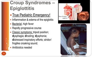 Croup Syndromes –
Epiglottitis
True Pediatric Emergency!
 Inflammation & edema of the epiglottis
 Bacterial, high fever
 Rapidly progressive course
 Classic symptoms: tripod position;
dysphagia; drooling; dysphonia;
distressed inspiratory efforts; stridor/
froglike croaking sound;
 Antibiotics needed
74
 