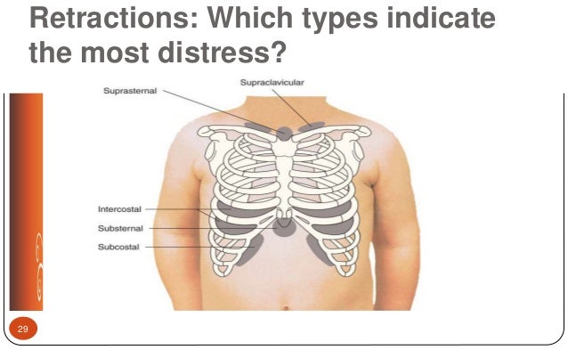 Respiratory lecture nurs 3340 fall 2017