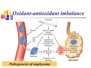 Pathogenesis of emphysema
Oxidant-antioxidant imbalance
 