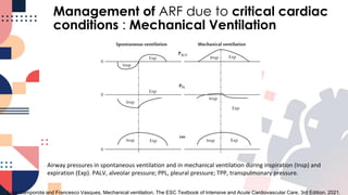 Respiratory Management in Acute Cardiac Care.pdf