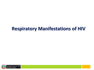 National Centre for AIDS
and STD Control
Respiratory Manifestations of HIV
 