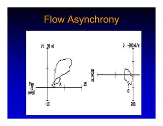 Respiratory Mechanics | PDF